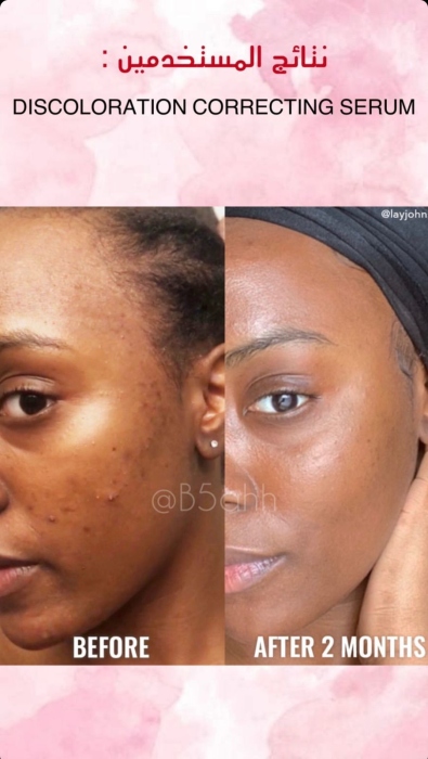 Good molecules, Discoloration Correcting Serum